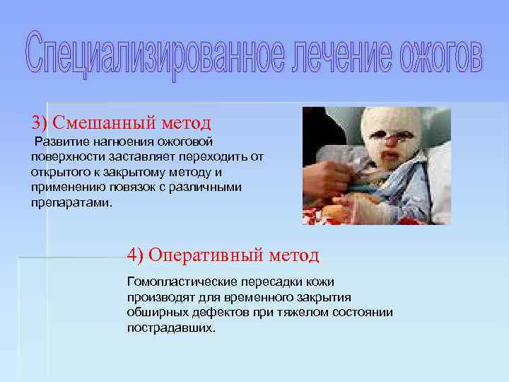 3) Смешанный метод Развитие нагноения ожоговой поверхности заставляет переходить от открытого к закрытому методу