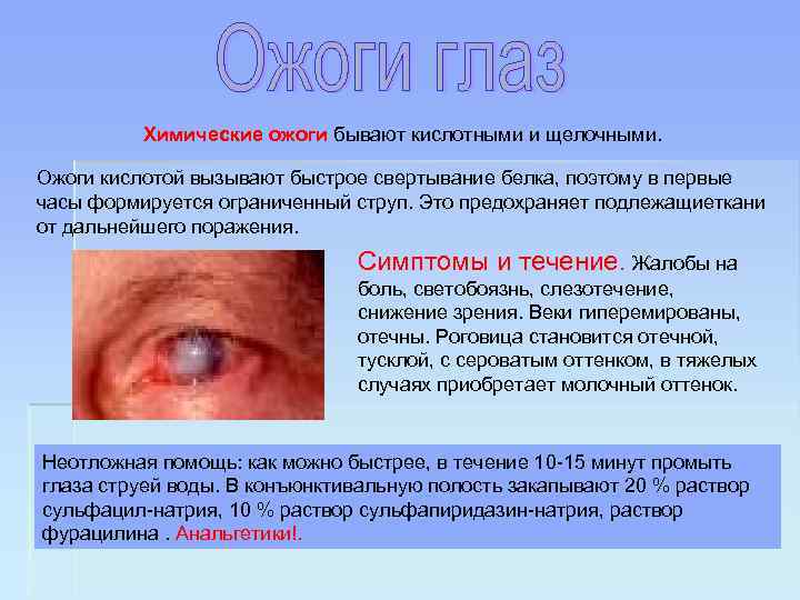 Химические ожоги бывают кислотными и щелочными. Ожоги кислотой вызывают быстрое свертывание белка, поэтому в