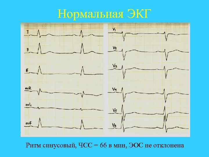 Приложение экг не доступно в вашем регионе