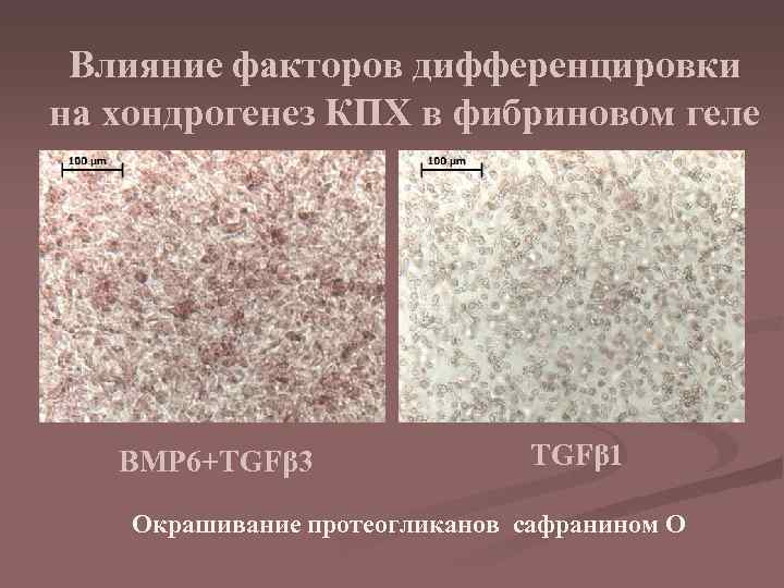 Влияние факторов дифференцировки на хондрогенез КПХ в фибриновом геле BMP 6+TGFβ 3 TGFβ 1