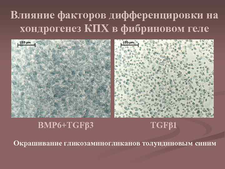 Влияние факторов дифференцировки на хондрогенез КПХ в фибриновом геле BMP 6+TGFβ 3 TGFβ 1