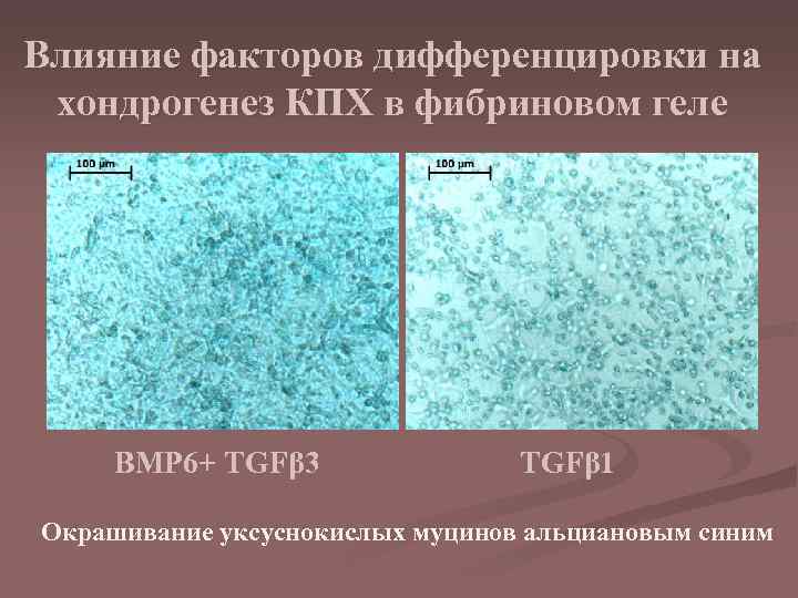 Влияние факторов дифференцировки на хондрогенез КПХ в фибриновом геле BMP 6+ TGFβ 3 TGFβ