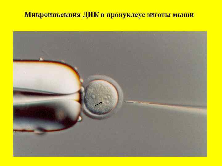 Микроинъекция ДНК в пронуклеус зиготы мыши 
