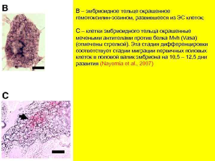В – эмбриоидное тельце окрашенное гемотоксилин-эозином, развившееся из ЭС клеток; С – клетки эмбриоидного