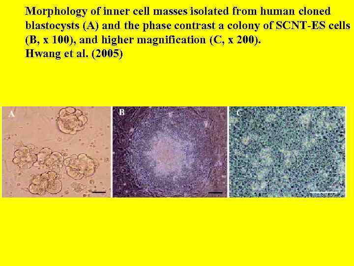 Morphology of inner cell masses isolated from human cloned blastocysts (A) and the phase