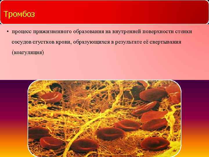 Какие анатомические образования имеются на внутренней поверхности стенок atrium dextrum