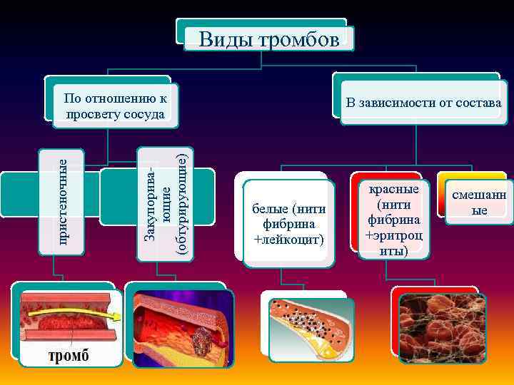 Схема образования сгустка в просвете сосуда