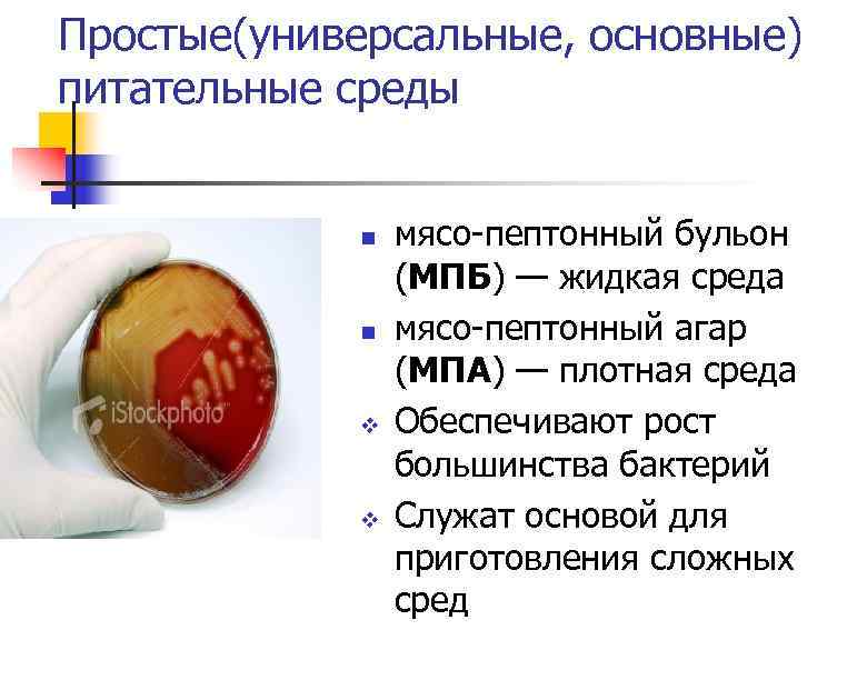 Простые(универсальные, основные) питательные среды n n v v мясо-пептонный бульон (МПБ) — жидкая среда
