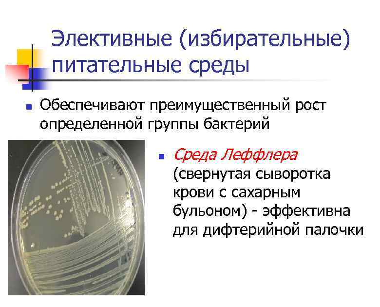 Элективные (избирательные) питательные среды n Обеспечивают преимущественный рост определенной группы бактерий n Среда Леффлера