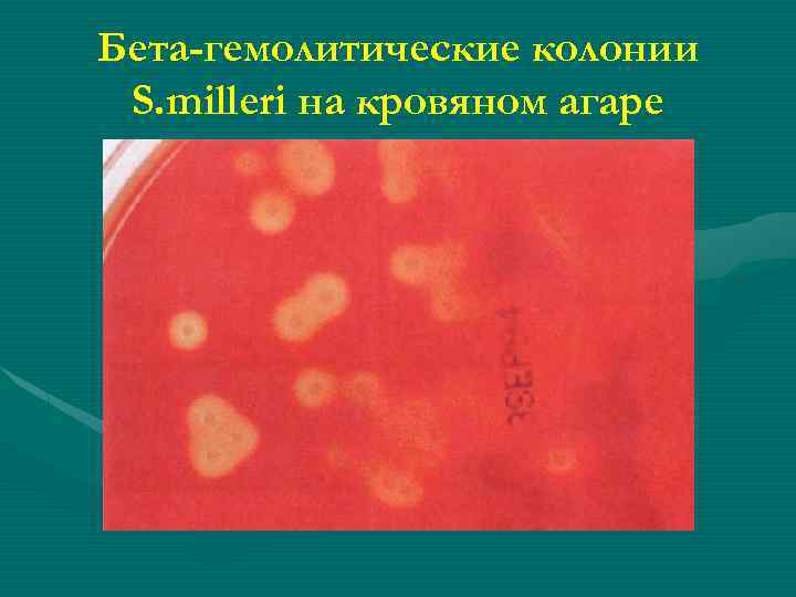 Бета-гемолитические колонии S. milleri на кровяном агаре 