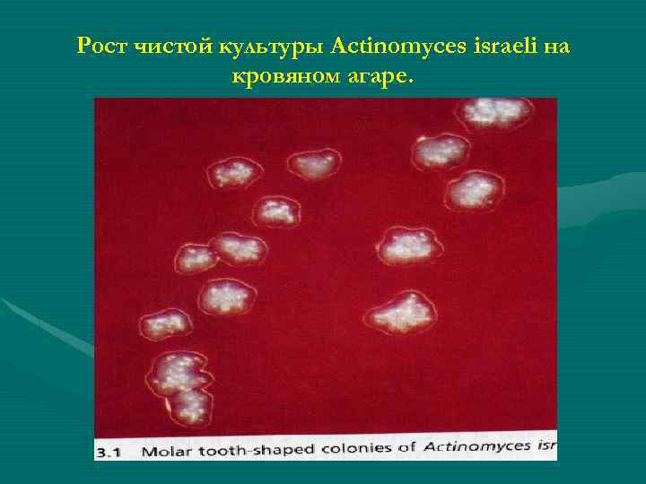 Рост чистой культуры Actinomyces israeli на кровяном агаре. 