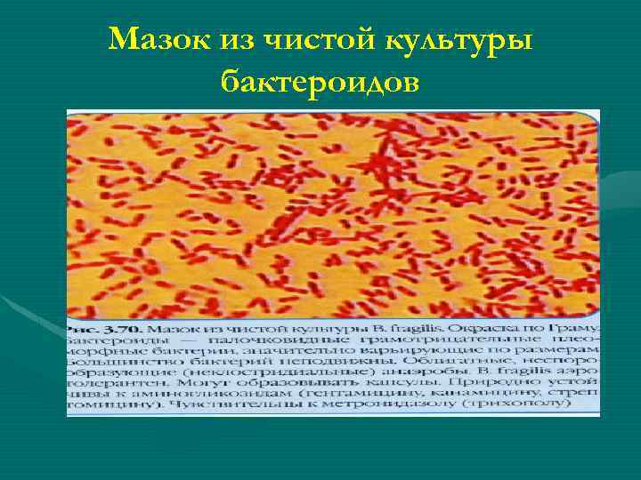 Мазок из чистой культуры бактероидов 