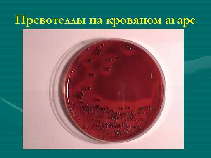 Превотеллы на кровяном агаре 