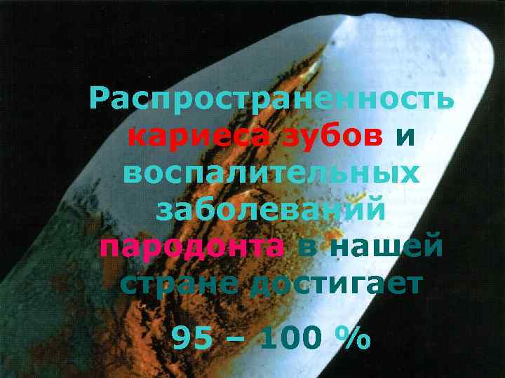 Распространенность кариеса зубов и воспалительных заболеваний пародонта в нашей стране достигает 95 – 100
