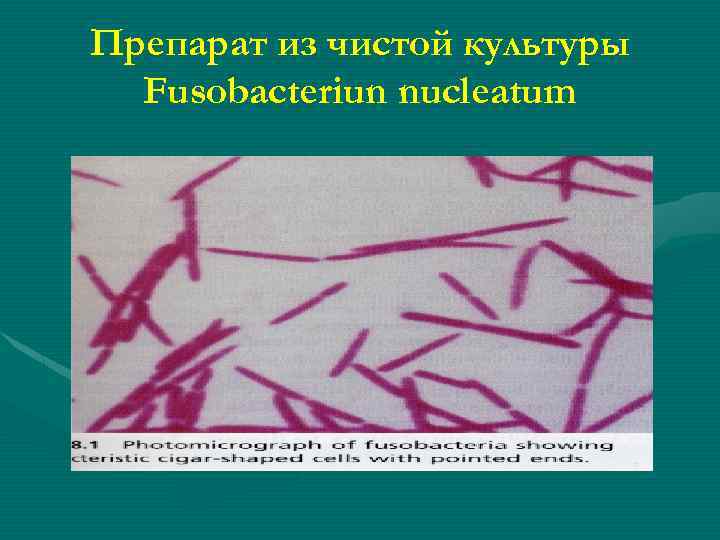 Препарат из чистой культуры Fusobacteriun nucleatum 