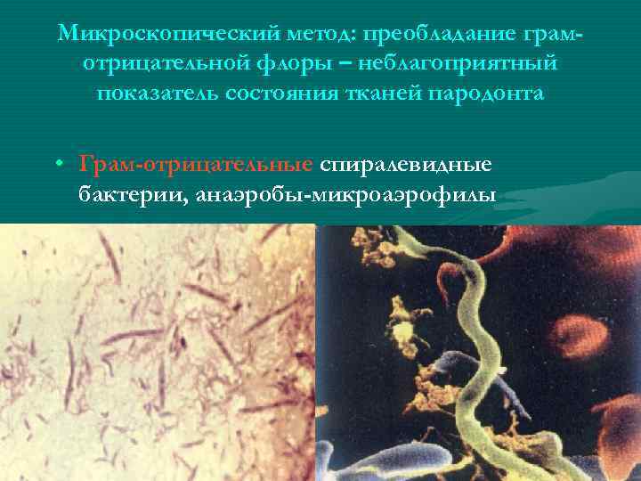 Микроскопический метод: преобладание грамотрицательной флоры – неблагоприятный показатель состояния тканей пародонта • Грам-отрицательные спиралевидные