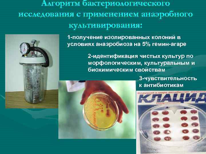 Алгоритм бактериологического исследования с применением анаэробного культивирования: 1 -получение изолированных колоний в условиях анаэробиоза