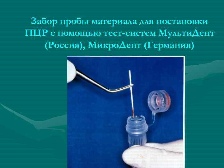 Забор пробы материала для постановки ПЦР с помощью тест-систем Мульти. Дент (Россия), Микро. Дент