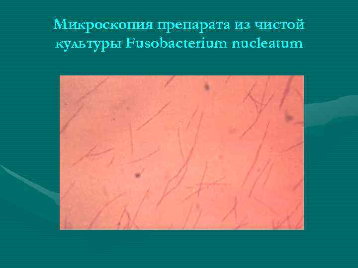 Микроскопия препарата из чистой культуры Fusobacterium nucleatum 