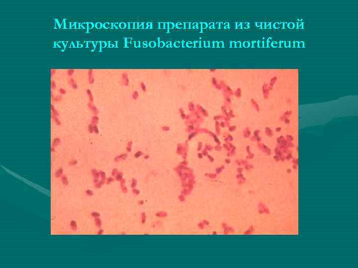 Микроскопия препарата из чистой культуры Fusobacterium mortiferum 