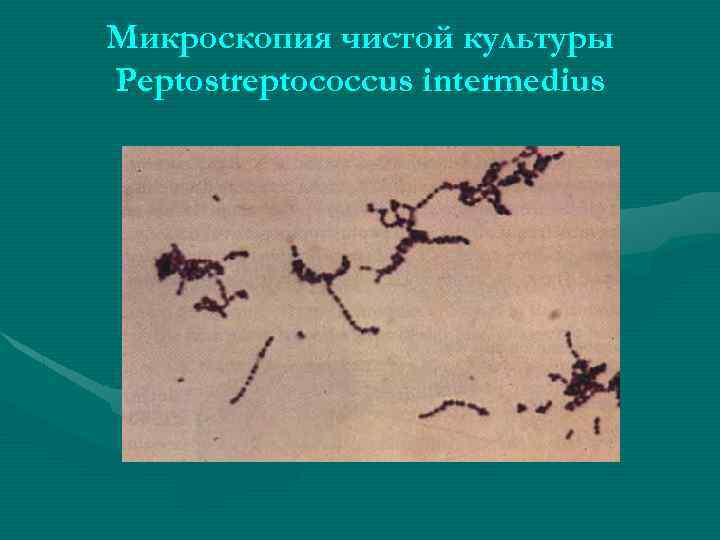 Микроскопия чистой культуры Peptostreptococcus intermedius 