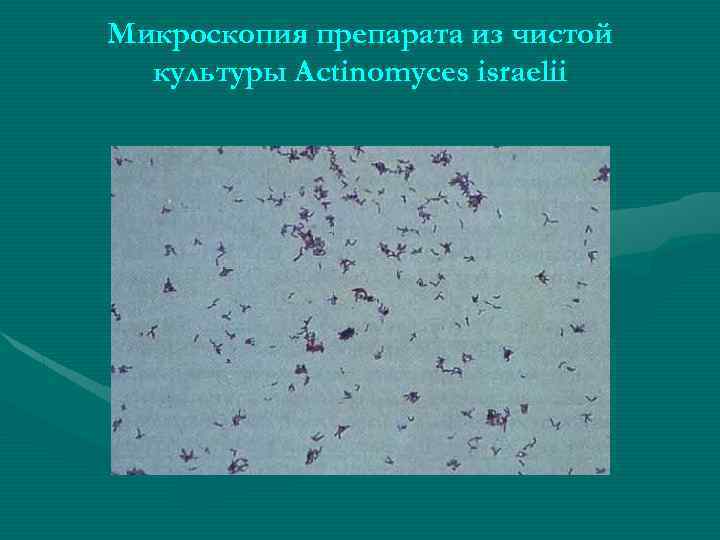 Микроскопия препарата из чистой культуры Аctinomyces israelii 