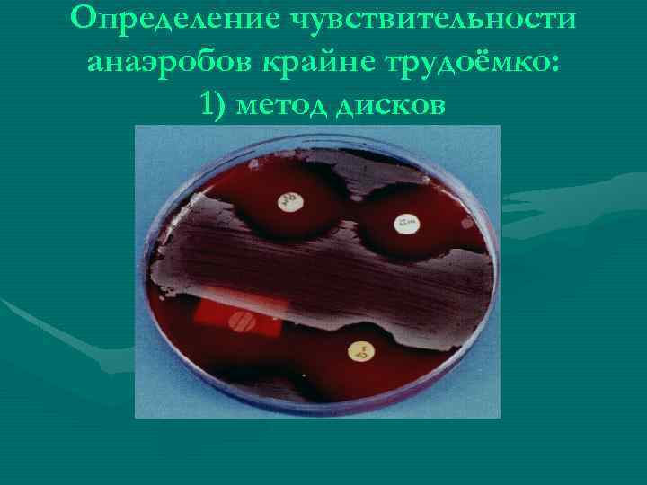 Определение чувствительности анаэробов крайне трудоёмко: 1) метод дисков 