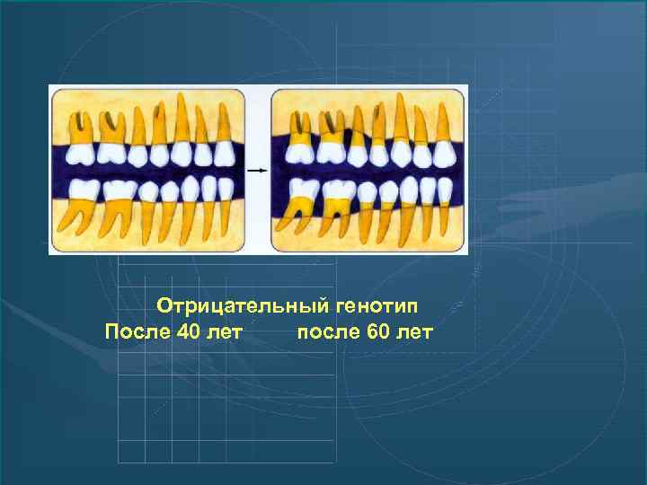 Отрицательный генотип После 40 лет после 60 лет 