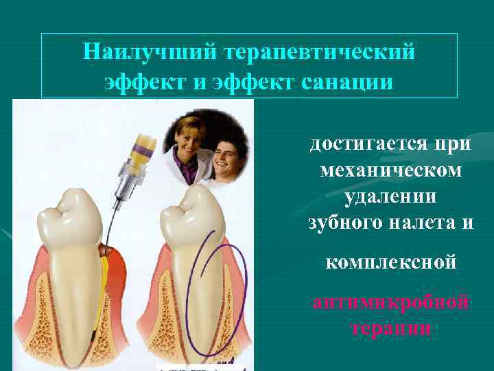Наилучший терапевтический эффект и эффект санации достигается при механическом удалении зубного налета и комплексной