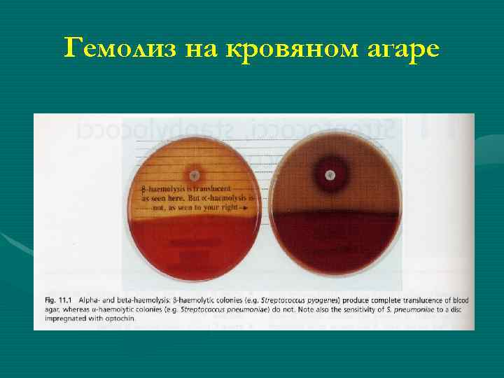 Гемолиз на кровяном агаре 