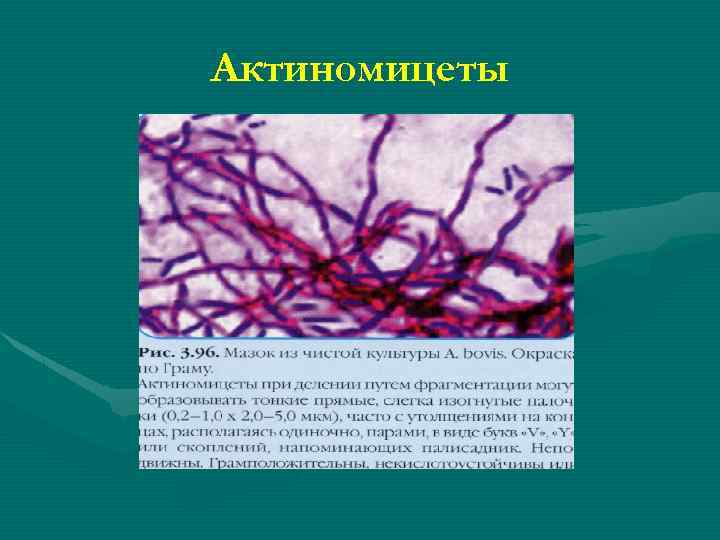 Актиномицеты 