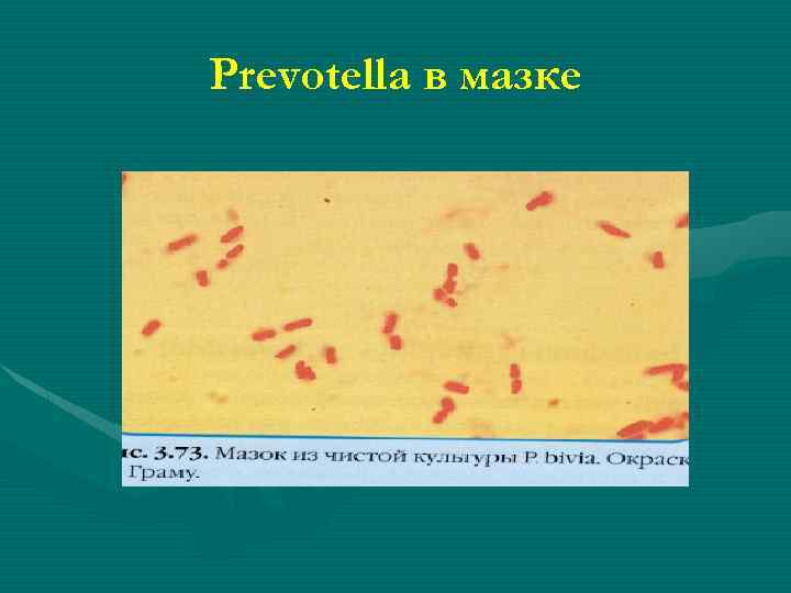Prevotella в мазке 