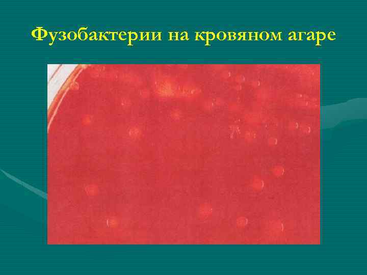 Фузобактерии на кровяном агаре 