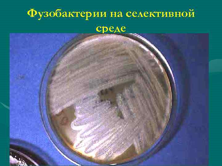 Фузобактерии на селективной среде 