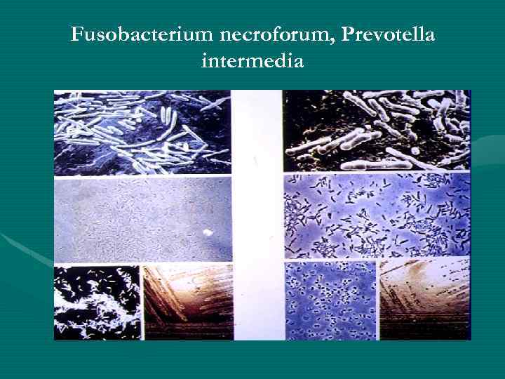 Fusobacterium necroforum, Prevotella intermedia 