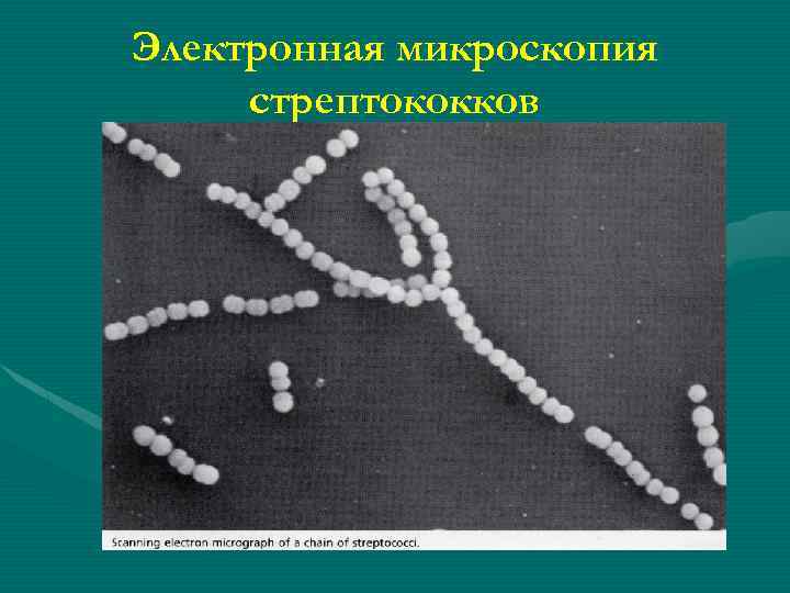 Электронная микроскопия стрептококков 