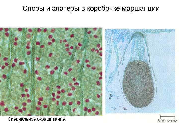 Споры и элатеры в коробочке маршанции Специальное окрашивание 
