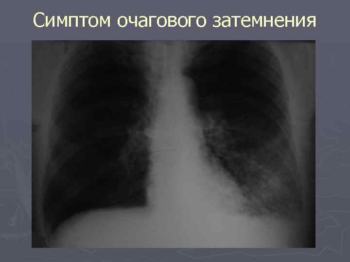 При рентгеноскопии изображение получается