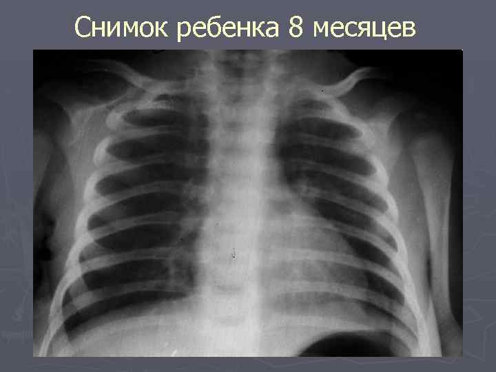 Снимок ребенка 8 месяцев 