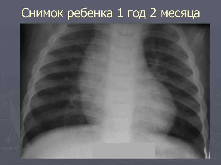 Снимок ребенка 1 год 2 месяца 