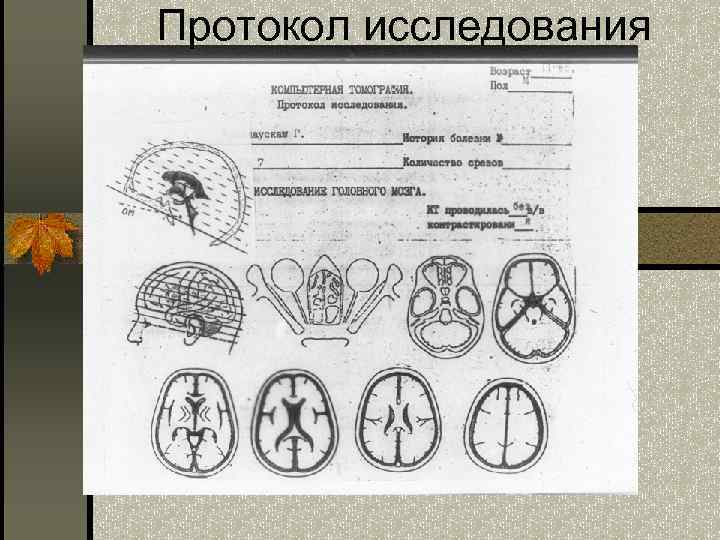 Протокол исследования 