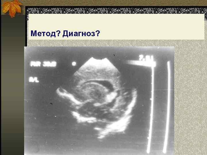 3 Метод? Диагноз? 
