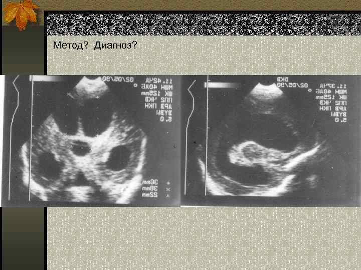 7 Метод? Диагноз? 