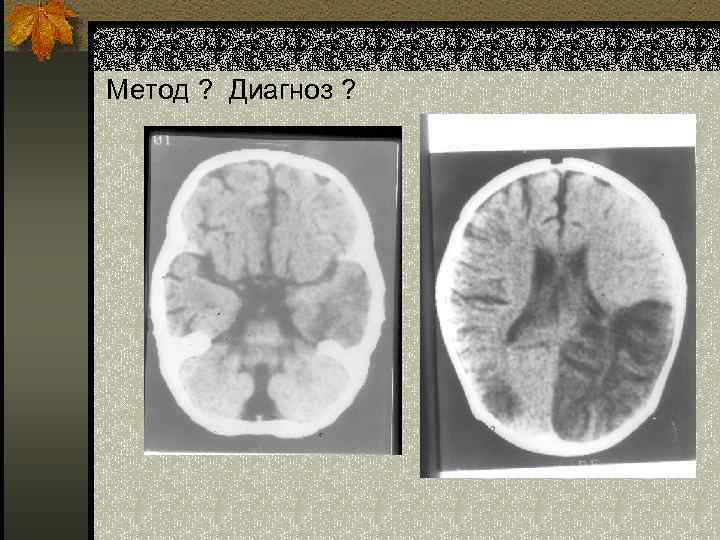 Метод ? Диагноз ? 