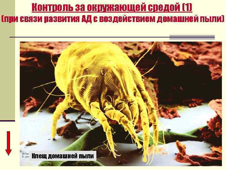 Контроль за окружающей средой (1) (при связи развития АД с воздействием домашней пыли) Клещ