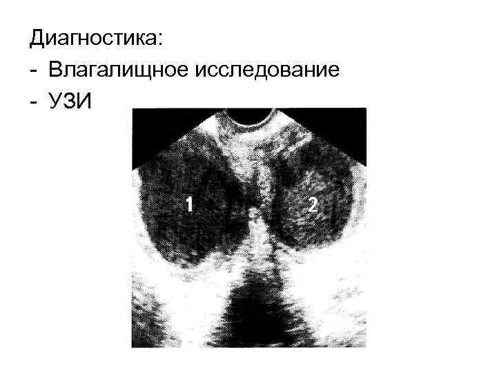 Диагностика: Влагалищное исследование УЗИ 