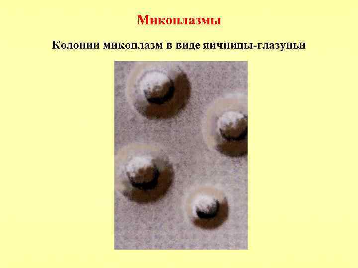 Микоплазмы Колонии микоплазм в виде яичницы-глазуньи 