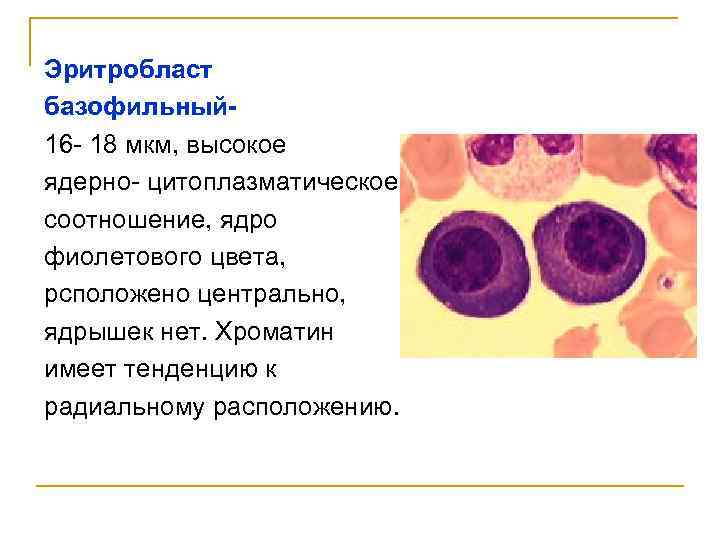 Эритробласт базофильный 16 - 18 мкм, высокое ядерно- цитоплазматическое соотношение, ядро фиолетового цвета, рсположено