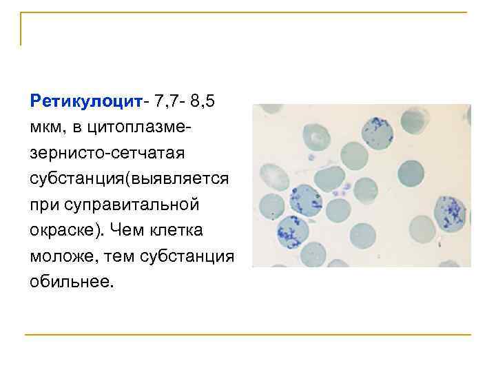 Ретикулоцит- 7, 7 - 8, 5 мкм, в цитоплазмезернисто-сетчатая субстанция(выявляется при суправитальной окраске). Чем