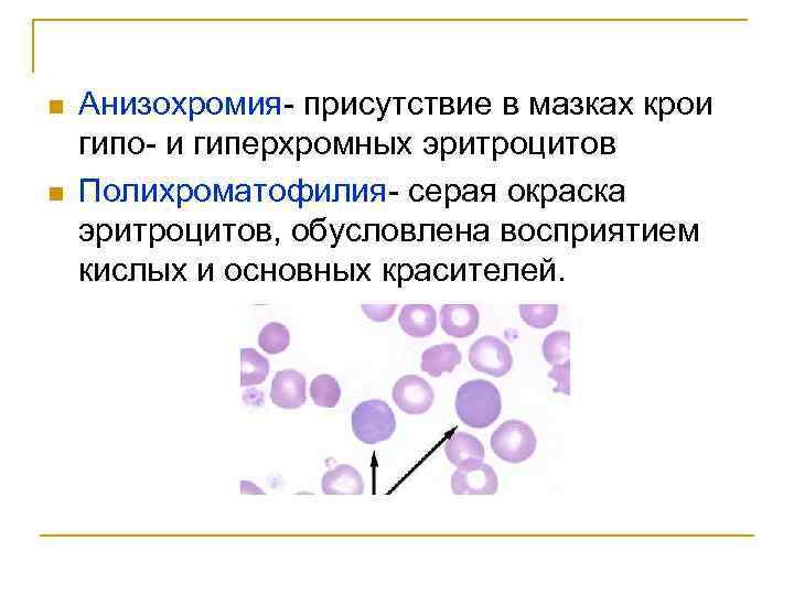 n n Анизохромия- присутствие в мазках крои гипо- и гиперхромных эритроцитов Полихроматофилия- серая окраска
